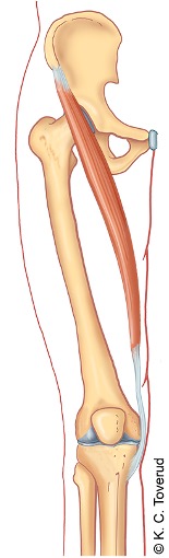 M. sartorius