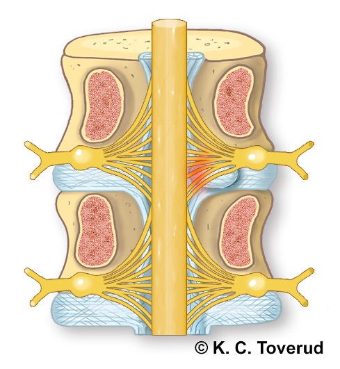 Cervical nerve roots run horizontally