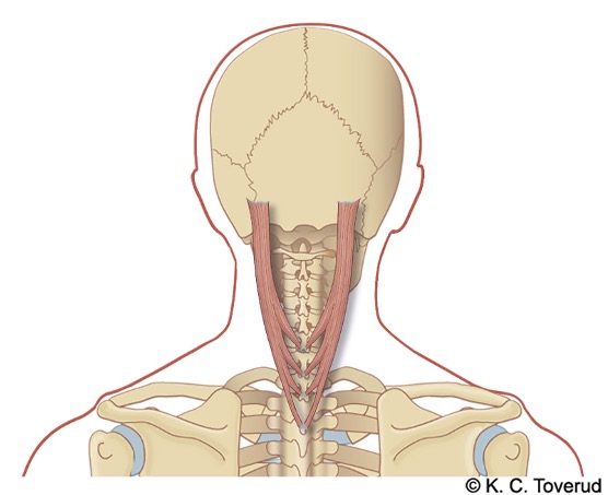 M. spinalis capitis