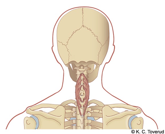 M. spinalis cervicis