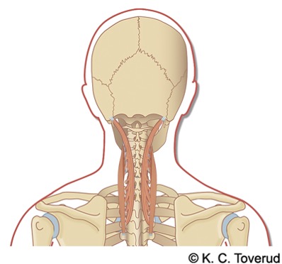 M. longissimus capitis et cervicis