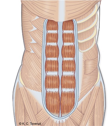 M. rectus abdominis