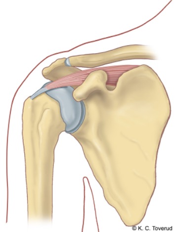 Skulder abduksjon, M. supraspinatus