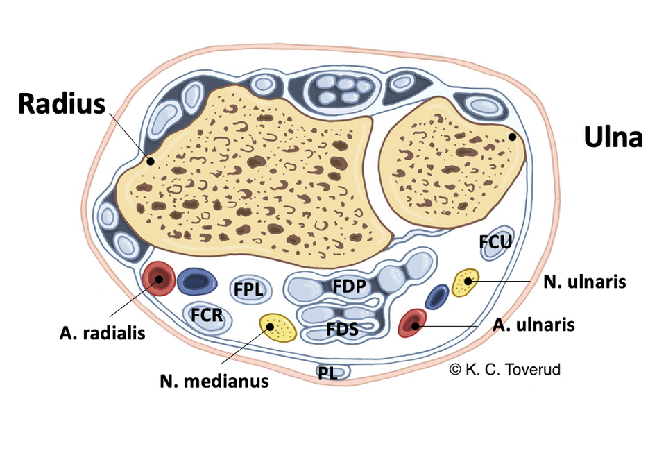 Sener i retinaculum musculorum flexorum manus